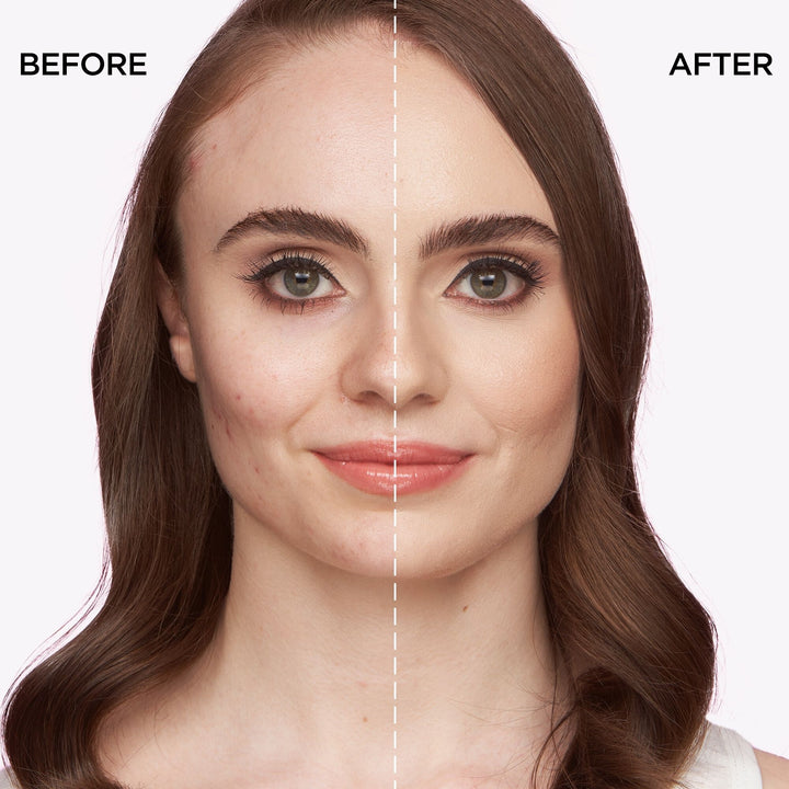 Tarte Shape Tape Contour Concealer 10Ml Fair Light Neutral