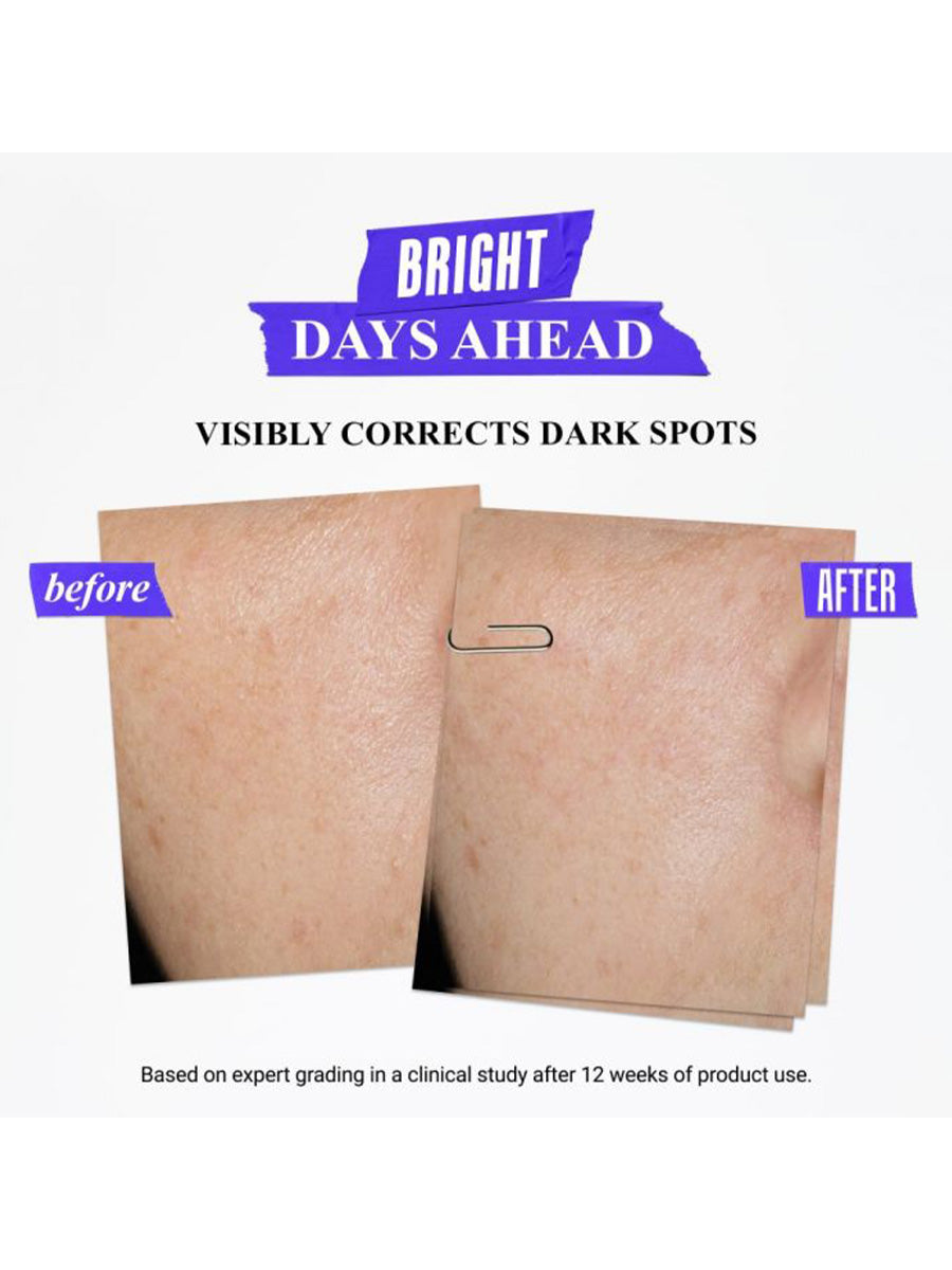 Kiehls Clearly Corrective Dark Spot Solution 100ml