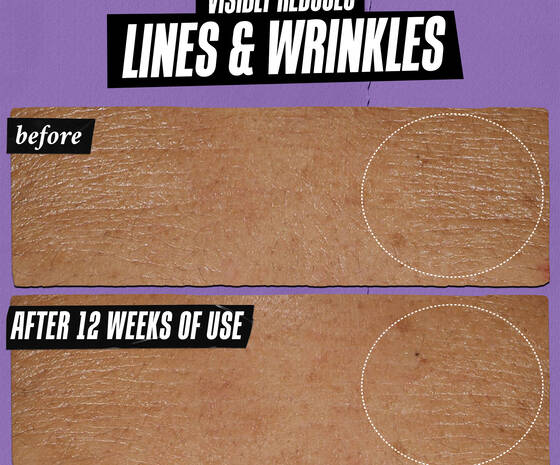 Kiehl's Retinol Skin-Renewing Daily Micro-Dose Serum 30ml