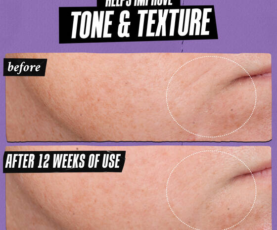 Kiehl's Retinol Skin-Renewing Daily Micro-Dose Serum 30ml