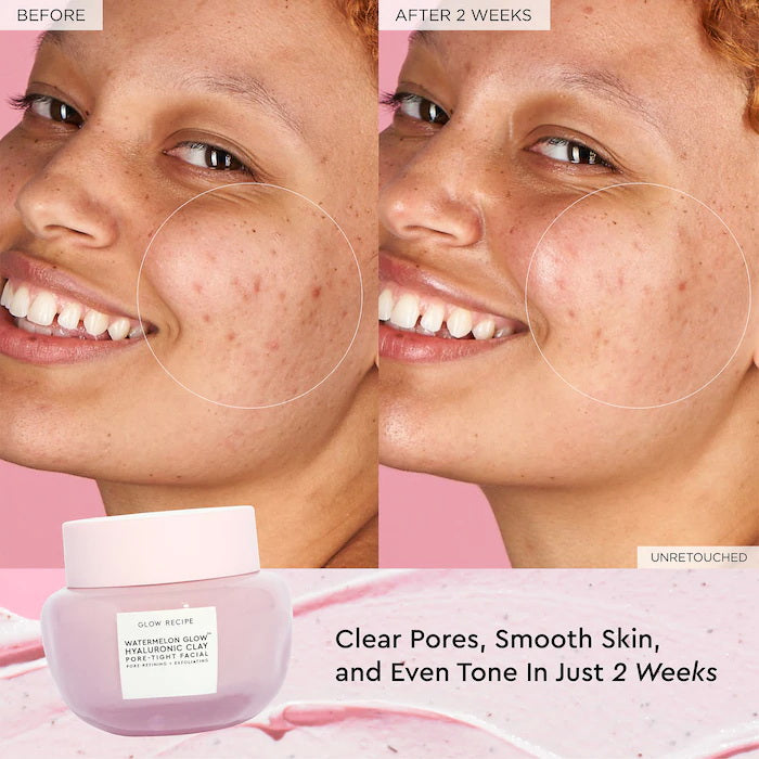 Glow Recipe Pore Tight Facial Hyaluronic Clay 60ml